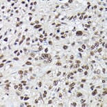 Immunohistochemistry - Anti-SC35 Antibody (A11667) - Antibodies.com