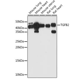 Western Blot - Anti-TGF beta 2 Antibody (A11669) - Antibodies.com