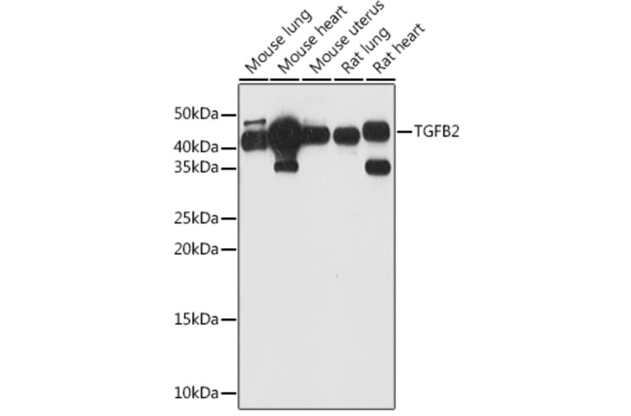 Western Blot - Anti-TGF beta 2 Antibody (A11669) - Antibodies.com