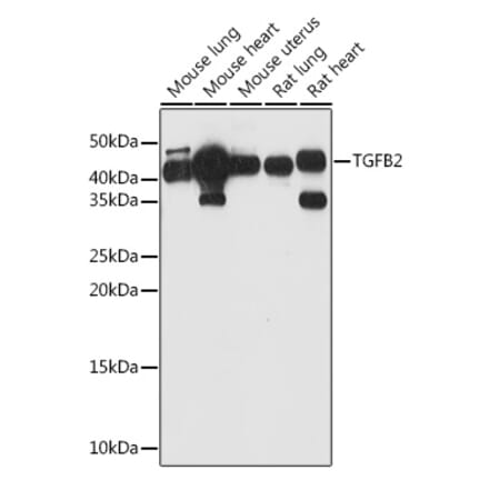 Western Blot - Anti-TGF beta 2 Antibody (A11669) - Antibodies.com