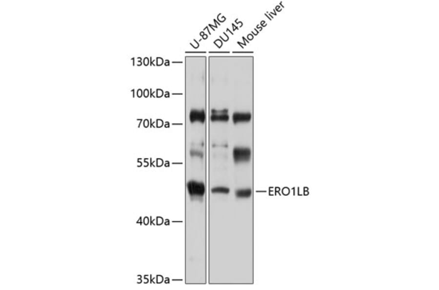 Western Blot - Anti-ERO1LB Antibody (A11670) - Antibodies.com