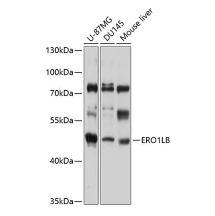 Western Blot - Anti-ERO1LB Antibody (A11670) - Antibodies.com