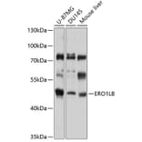 Western Blot - Anti-ERO1LB Antibody (A11670) - Antibodies.com