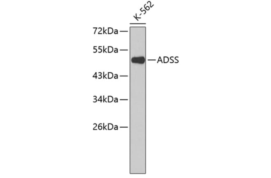 Western Blot - Anti-ADSS Antibody (A3720) - Antibodies.com