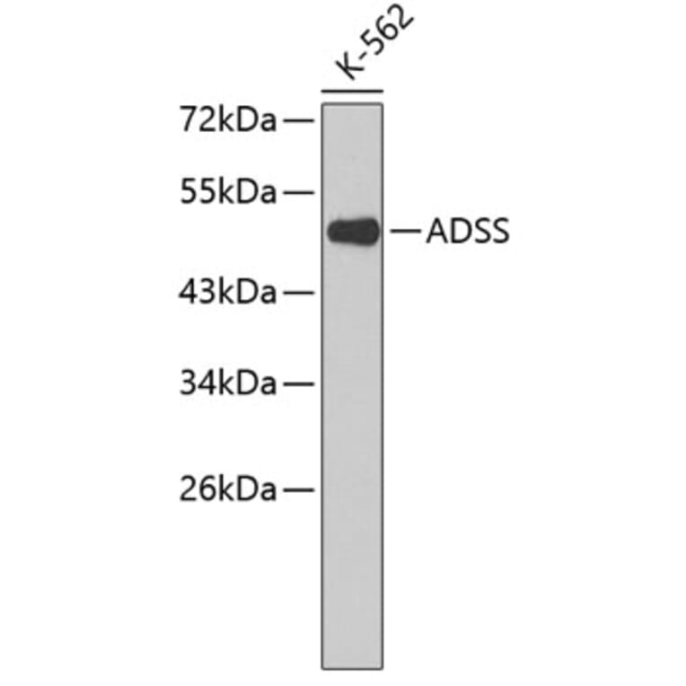 Western Blot - Anti-ADSS Antibody (A3720) - Antibodies.com