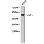 Western Blot - Anti-ADSS Antibody (A3720) - Antibodies.com