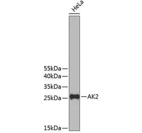 Western Blot - Anti-AK2 Antibody (A11673) - Antibodies.com