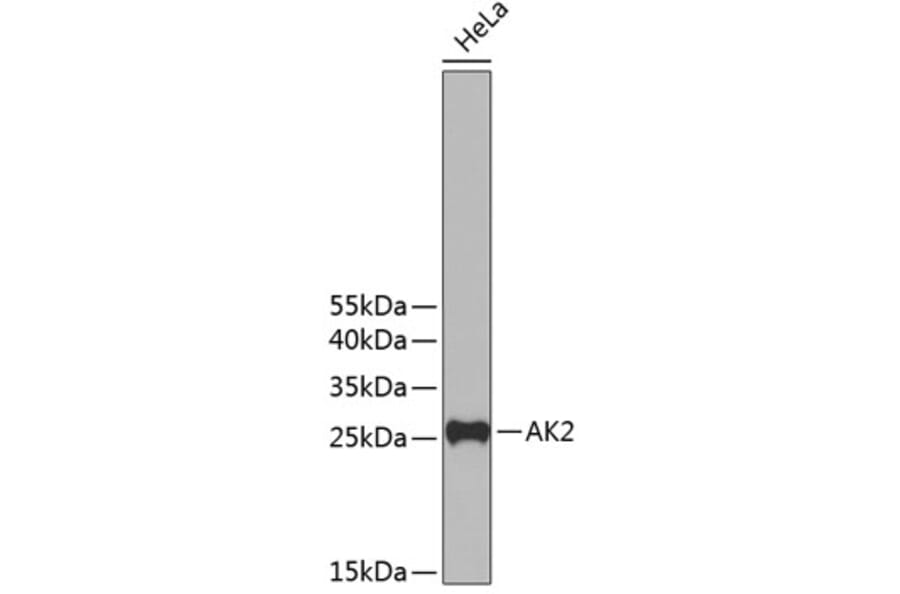 Western Blot - Anti-AK2 Antibody (A11673) - Antibodies.com