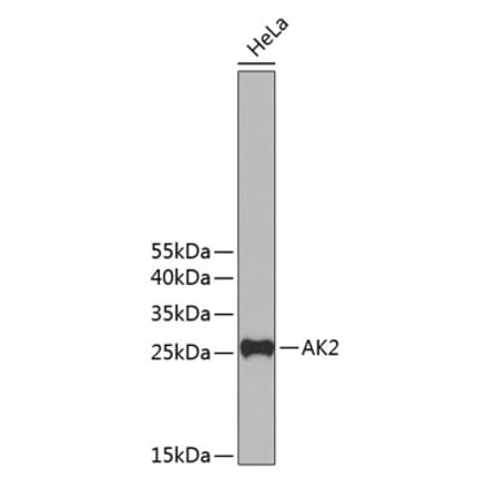 Western Blot - Anti-AK2 Antibody (A11673) - Antibodies.com
