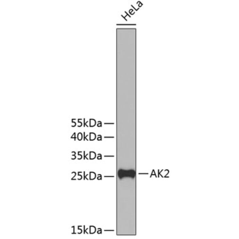 Western Blot - Anti-AK2 Antibody (A11673) - Antibodies.com