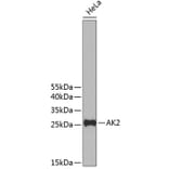 Western Blot - Anti-AK2 Antibody (A11673) - Antibodies.com