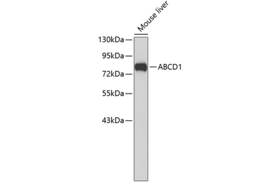 Western Blot - Anti-ABCD1 Antibody (A3724) - Antibodies.com