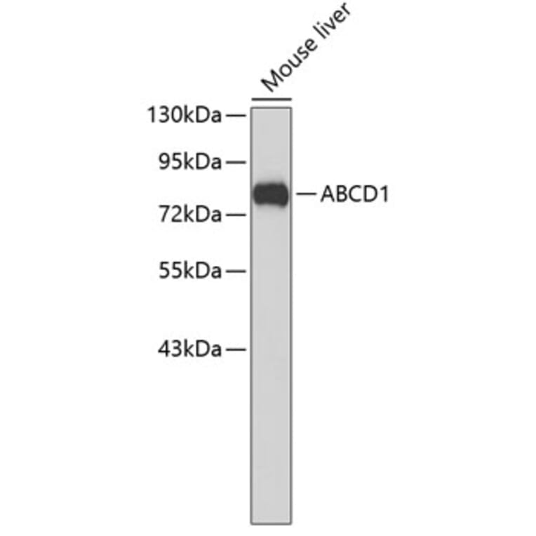 Western Blot - Anti-ABCD1 Antibody (A3724) - Antibodies.com