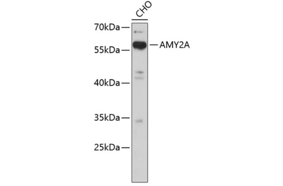Western Blot - Anti-AMY2A Antibody (A3732) - Antibodies.com
