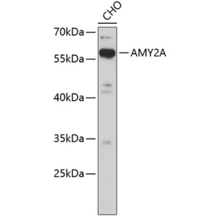 Western Blot - Anti-AMY2A Antibody (A3732) - Antibodies.com