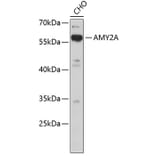 Western Blot - Anti-AMY2A Antibody (A3732) - Antibodies.com