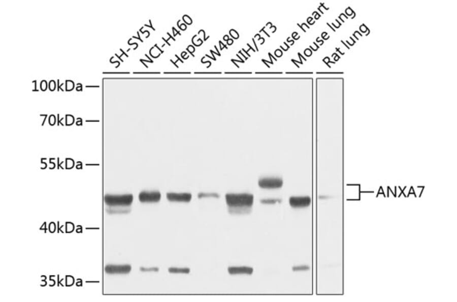 Western Blot - Anti-Annexin-7/ANXA7 Antibody (A11676) - Antibodies.com