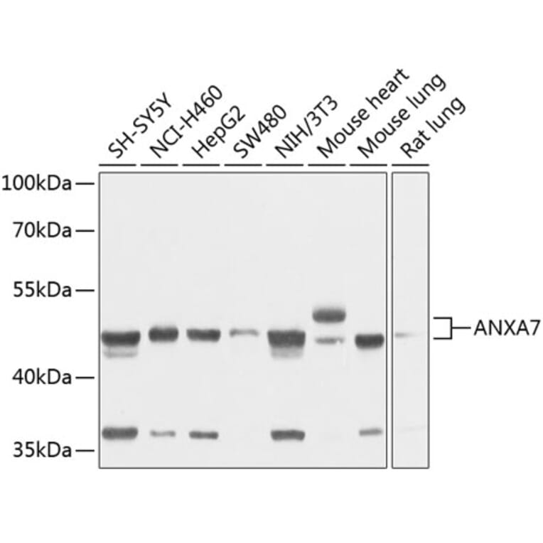 Western Blot - Anti-Annexin-7/ANXA7 Antibody (A11676) - Antibodies.com