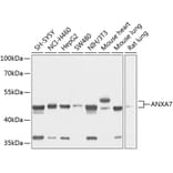 Western Blot - Anti-Annexin-7/ANXA7 Antibody (A11676) - Antibodies.com