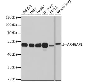 Western Blot - Anti-ARHGAP1 Antibody (A11677) - Antibodies.com