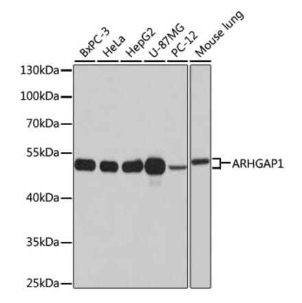 Western Blot - Anti-ARHGAP1 Antibody (A11677) - Antibodies.com