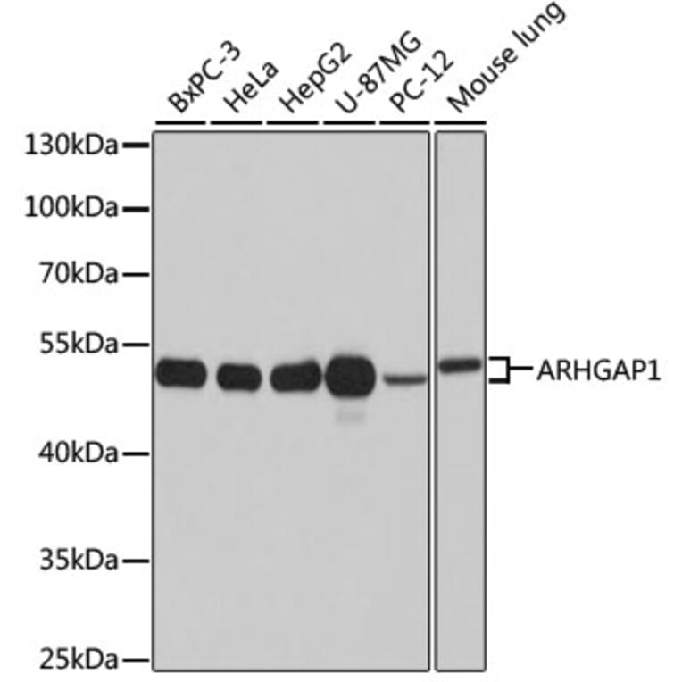 Western Blot - Anti-ARHGAP1 Antibody (A11677) - Antibodies.com
