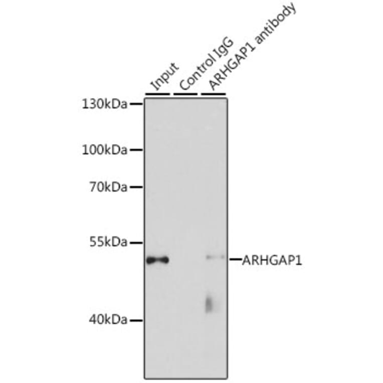 Western Blot - Anti-ARHGAP1 Antibody (A11677) - Antibodies.com