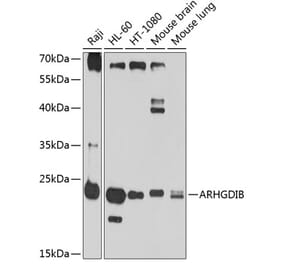 Western Blot - Anti-D4 GDI Antibody (A11678) - Antibodies.com