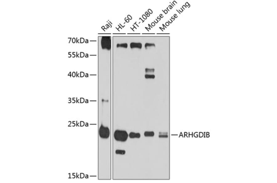 Western Blot - Anti-D4 GDI Antibody (A11678) - Antibodies.com