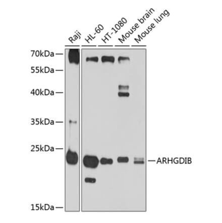 Western Blot - Anti-D4 GDI Antibody (A11678) - Antibodies.com