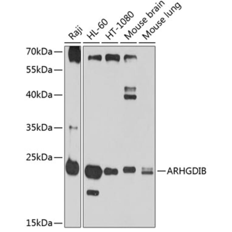 Western Blot - Anti-D4 GDI Antibody (A11678) - Antibodies.com