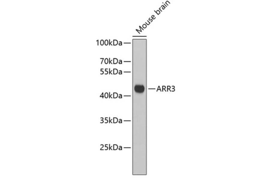 Western Blot - Anti-ARR3 Antibody (A3743) - Antibodies.com