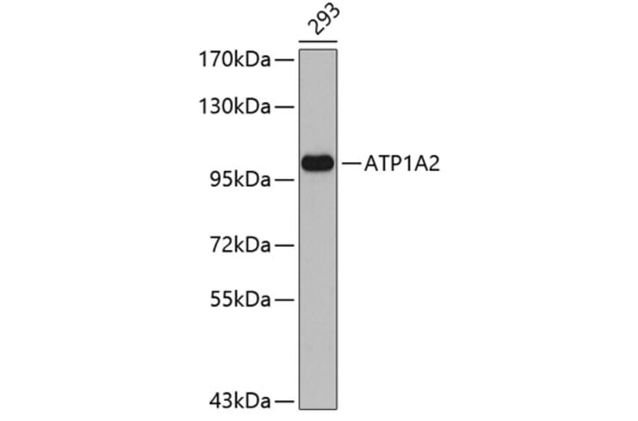 Western Blot - Anti-ATP1A2 Antibody (A3747) - Antibodies.com