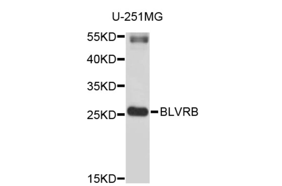 Western Blot - Anti-BLVRB Antibody (A3766) - Antibodies.com