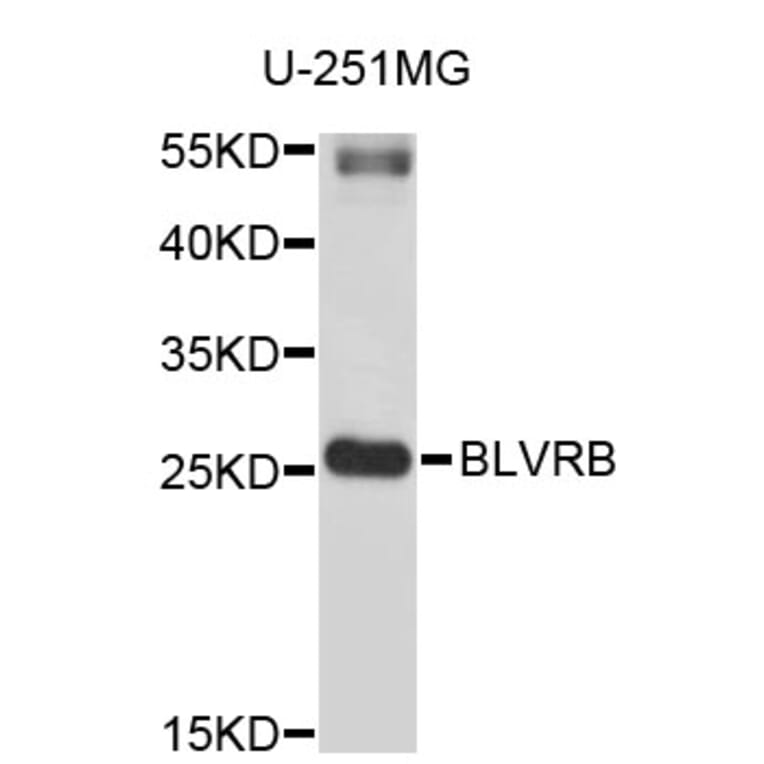 Western Blot - Anti-BLVRB Antibody (A3766) - Antibodies.com