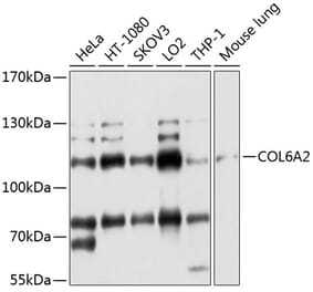 Western Blot - Anti-Collagen VI Antibody (A11686) - Antibodies.com