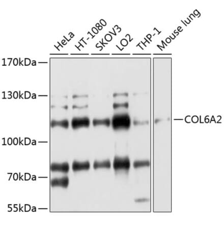 Western Blot - Anti-Collagen VI Antibody (A11686) - Antibodies.com