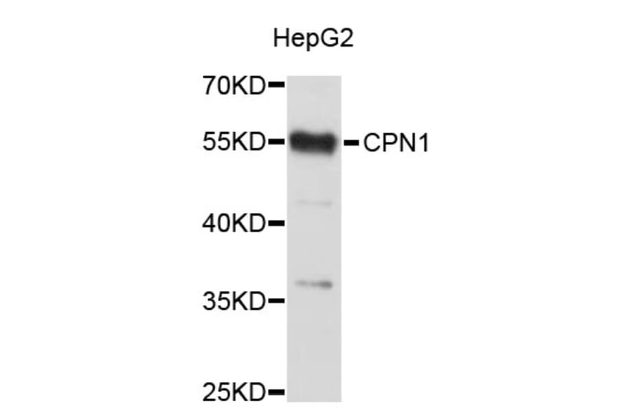 Western Blot - Anti-CPN1 Antibody (A3806) - Antibodies.com