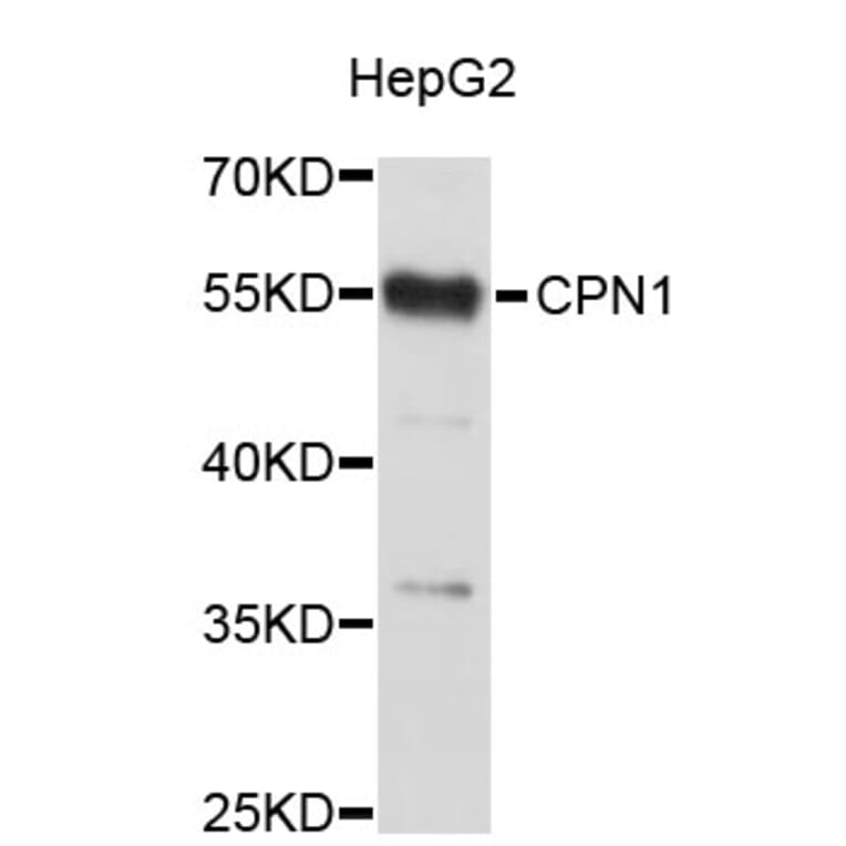 Western Blot - Anti-CPN1 Antibody (A3806) - Antibodies.com