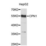 Western Blot - Anti-CPN1 Antibody (A3806) - Antibodies.com