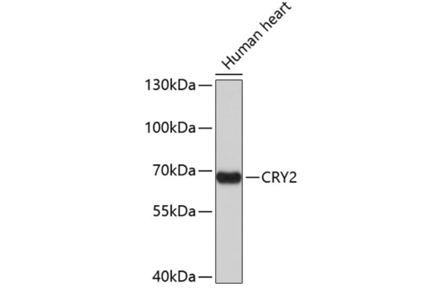 Western Blot - Anti-CRY2 Antibody (A3809) - Antibodies.com