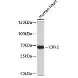 Western Blot - Anti-CRY2 Antibody (A3809) - Antibodies.com