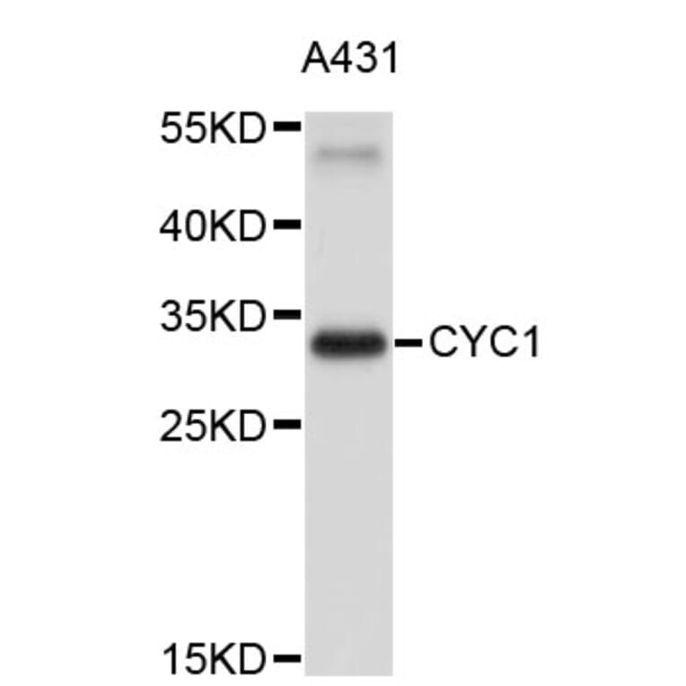 Western Blot - Anti-CYC1 Antibody (A3820) - Antibodies.com