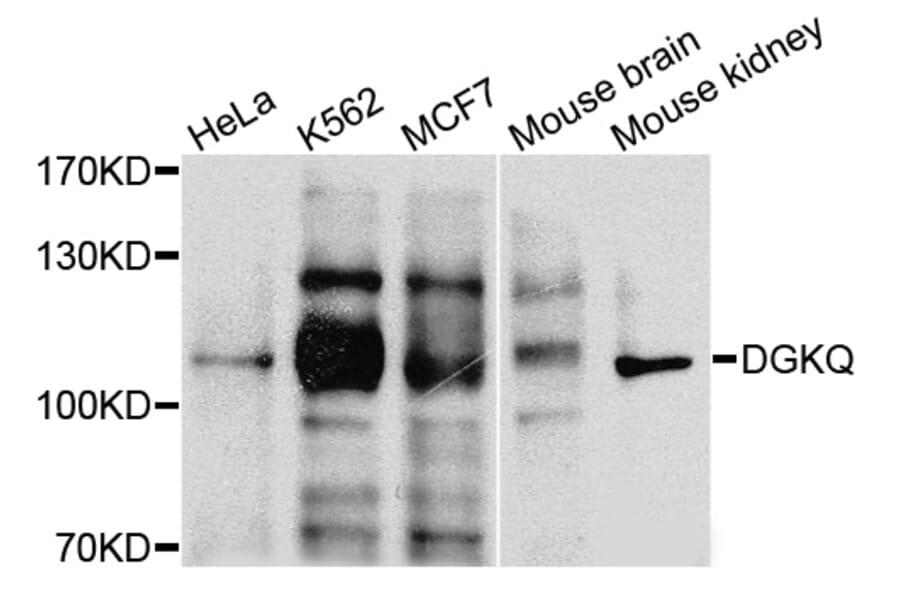 Western Blot - Anti-DGKQ Antibody (A3825) - Antibodies.com