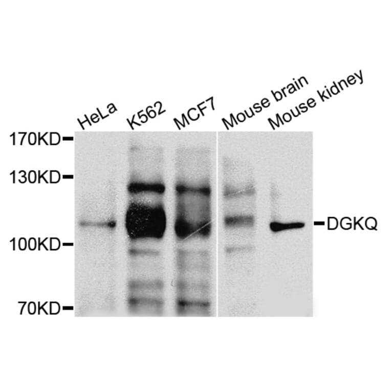 Western Blot - Anti-DGKQ Antibody (A3825) - Antibodies.com