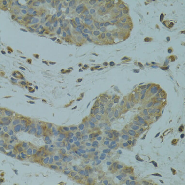 Immunohistochemistry - Anti-DGKQ Antibody (A3825) - Antibodies.com