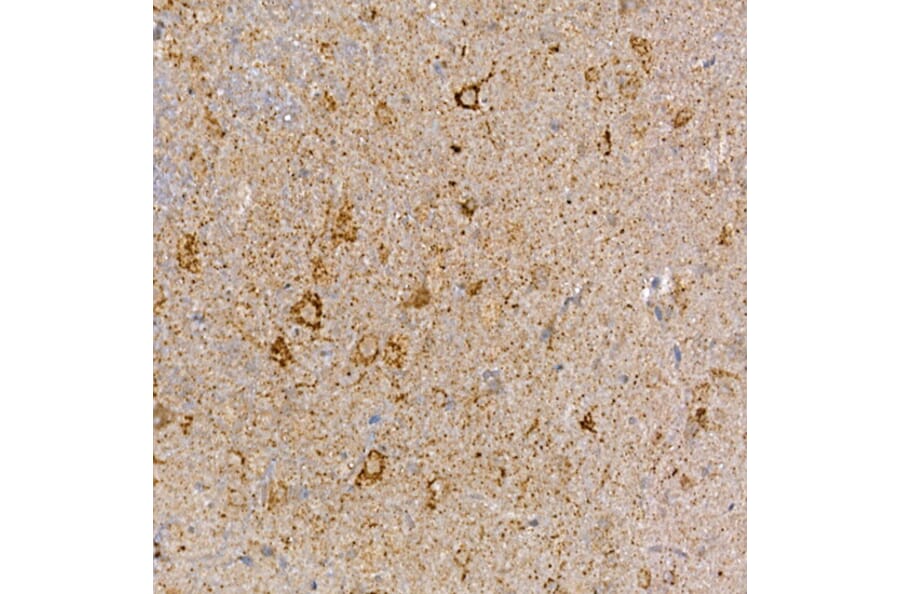 Immunohistochemistry - Anti-Dishevelled 3 Antibody (A11691) - Antibodies.com