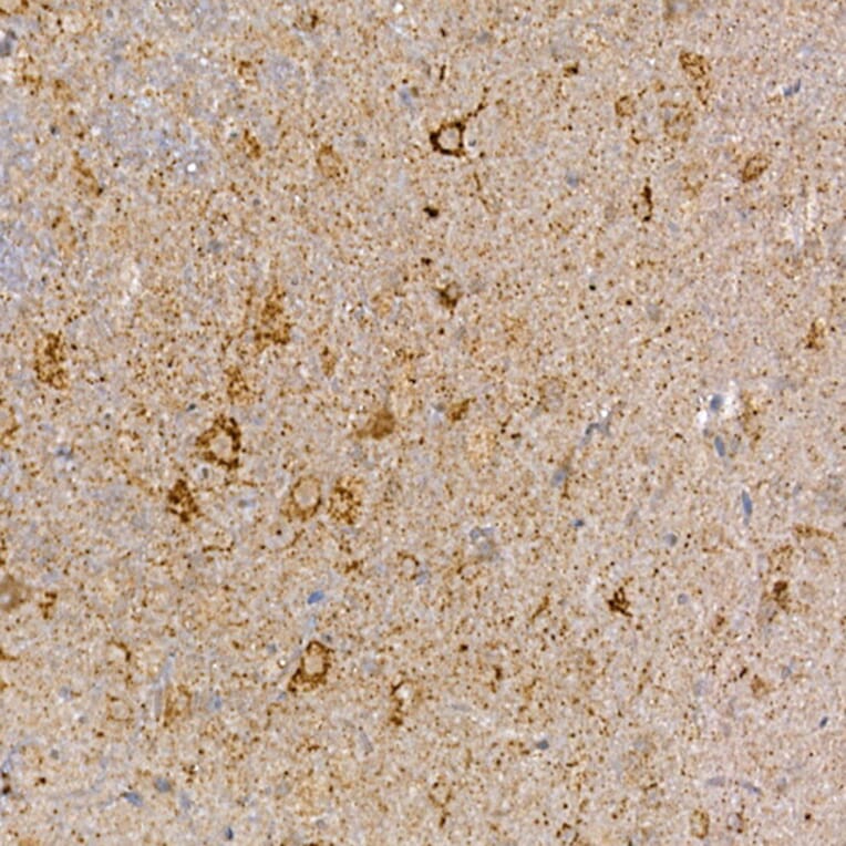 Immunohistochemistry - Anti-Dishevelled 3 Antibody (A11691) - Antibodies.com