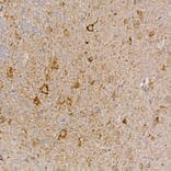 Immunohistochemistry - Anti-Dishevelled 3 Antibody (A11691) - Antibodies.com