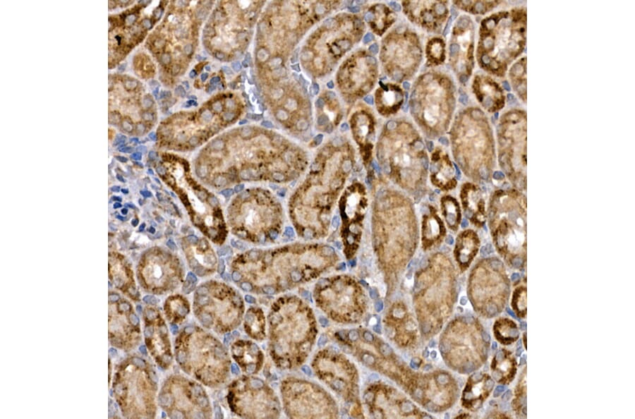 Immunohistochemistry - Anti-Dishevelled 3 Antibody (A11691) - Antibodies.com